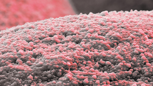 These tiny spheres are zeolite crystals that act as catalysts to speed up the chemical reaction in the production of amines. Magnification 2 600 :1 (12cm in width)